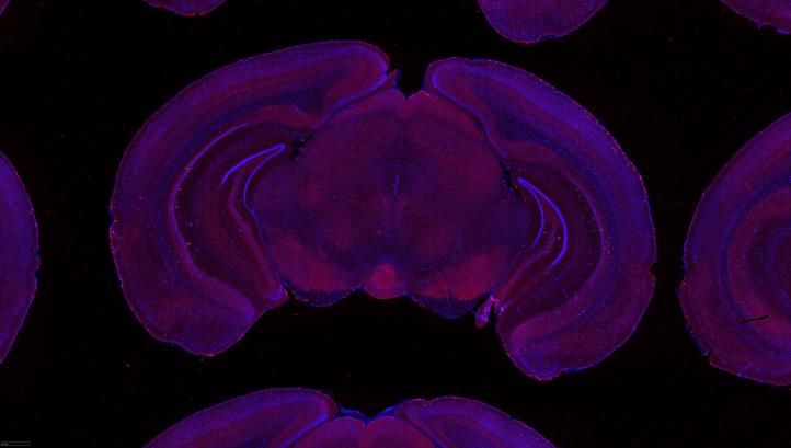 Image: Serial two-photon tomography of the whole mouse brain.