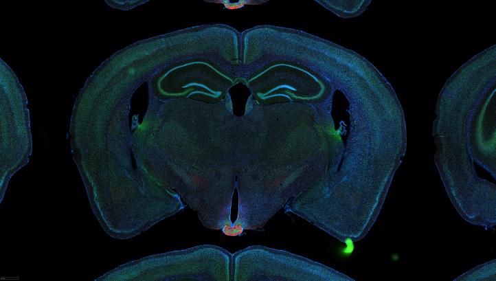 Image: Serial two-photon tomography of the whole mouse brain.